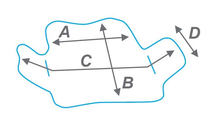 Функционально-корригирующий корсет (размер M) STABILO CONFORTABLE PLUS Noel купить в OrtoMir24