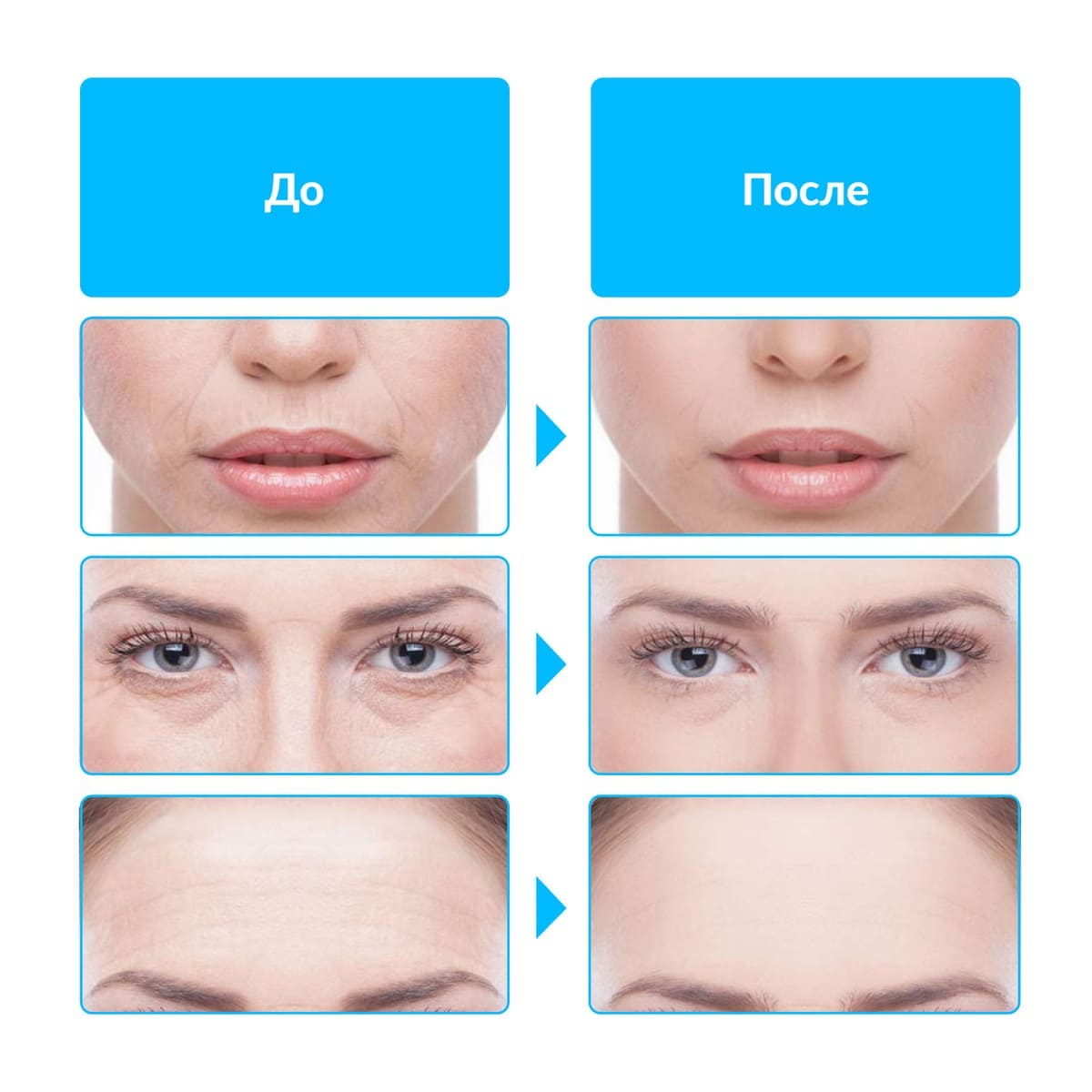 Аппарат для микротоковой терапии GESS-135 микротоки для лица купить в OrtoMir24